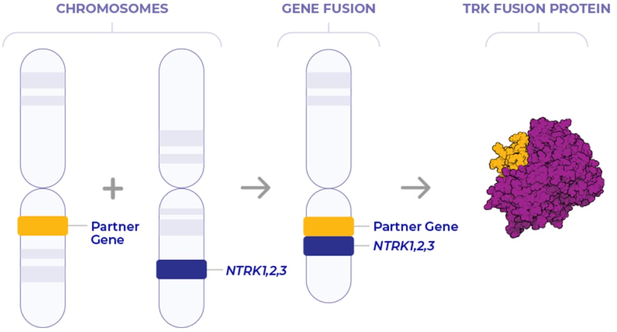 Formation of oncogenic TRK fusion proteins Graphic of the formation of oncogenic TRK fusion proteins in NTRK gene fusion
